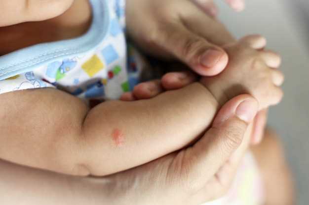 Как правильно лечить аллергический дерматит у ребенка?