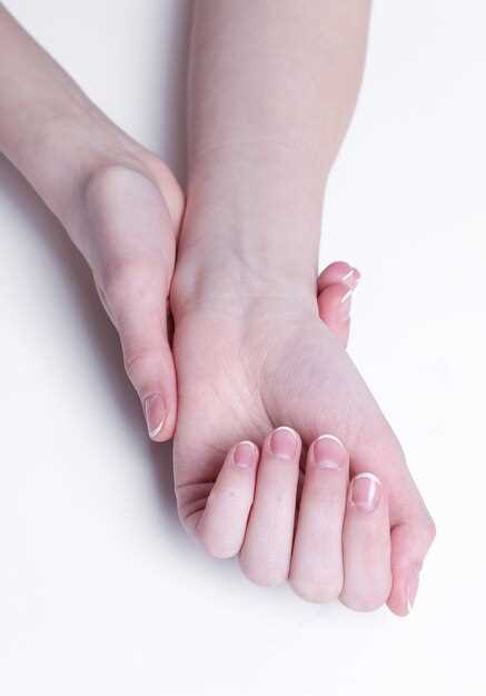 Причины возникновения белых пятен на ногтях