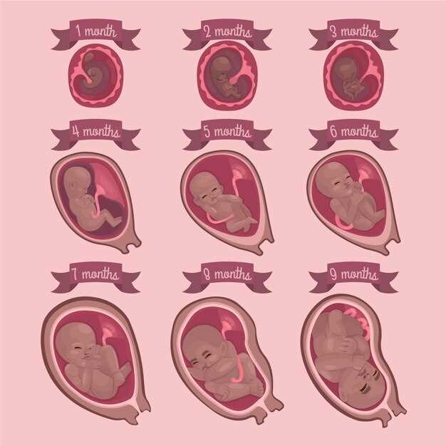 Местоположение плаценты во время беременности