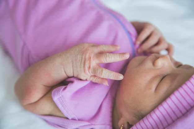 Причины высокого билирубина у новорожденного