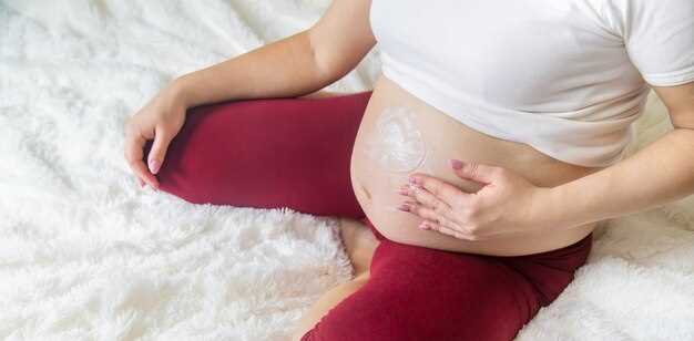 Советы для беременных: как предотвратить появление растяжек