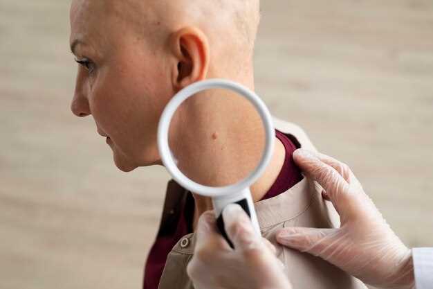 Как распознать рак кожи на ранней стадии