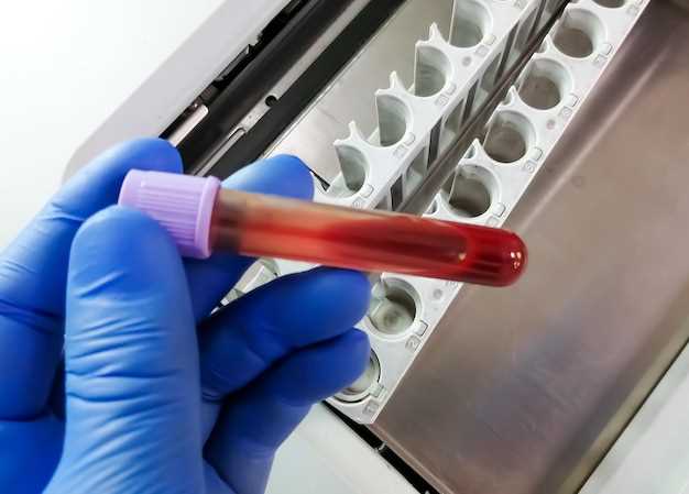 Определение тромбоза по анализу крови