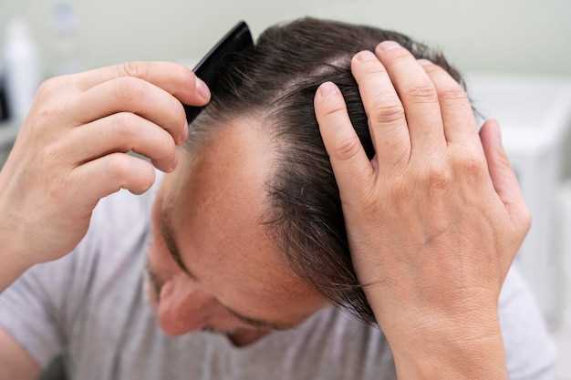Советы по предотвращению выпадения волос у мужчин