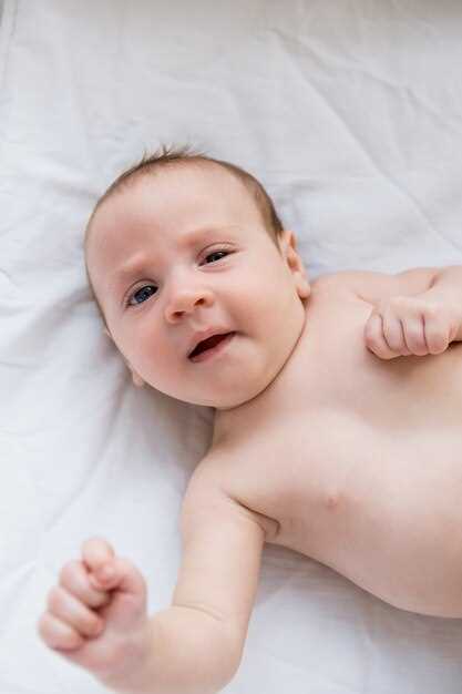 Описание основных признаков и симптомов потнички у малыша