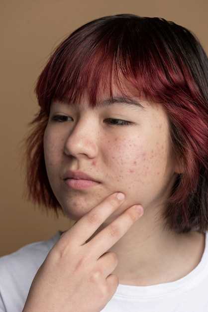 Рак кожи на лице у женщин: симптомы и признаки