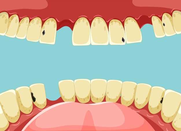 Виды кариозных поражений зубов