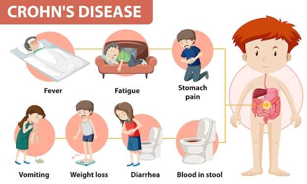 Симптомы кишечной инфекции у детей