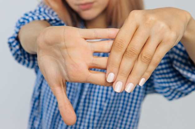 Основные причины слояния ногтей на руках у женщин