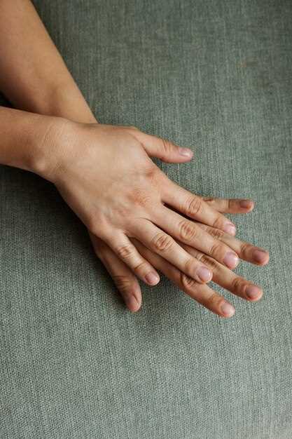 Причины отслаивания ногтей от кожи