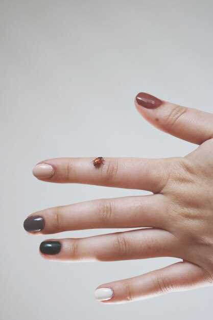 Факторы, влияющие на разделение ногтей от кожи