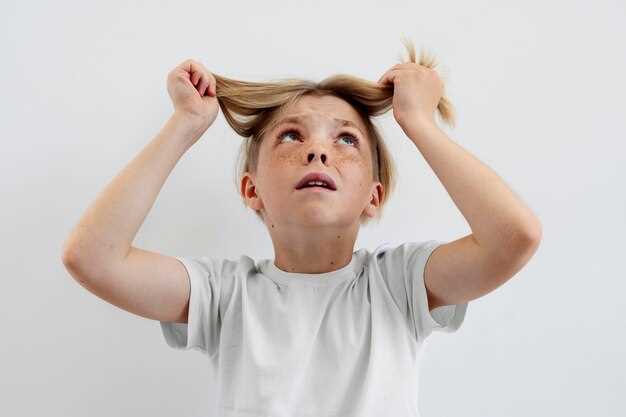 Неправильный уход за волосами может привести к перхоти у ребенка
